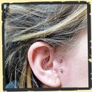 surface ear piercing