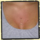 microdermals